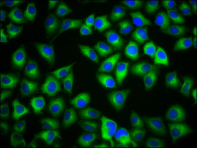 Immunocytochemistry/ Immunofluorescence - Anti-MC1-R antibody (AB236734)