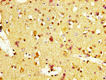Immunohistochemistry (Formalin/PFA-fixed paraffin-embedded sections) - Anti-MC1-R antibody (AB236734)
