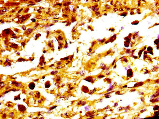 Immunohistochemistry (Formalin/PFA-fixed paraffin-embedded sections) - Anti-MC1-R antibody (AB236734)