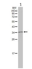 Western blot - Anti-MC1-R antibody (AB97321)