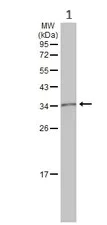 Western blot - Anti-MC1-R antibody (AB97321)