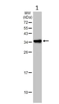 Western blot - Anti-MC1-R antibody (AB97321)