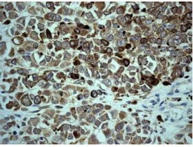 Immunohistochemistry (Formalin/PFA-fixed paraffin-embedded sections) - Anti-MC1-R antibody [EPR6530] (AB125031)