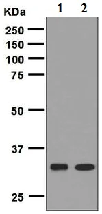 Western blot - Anti-MC1-R antibody [EPR6530] (AB125031)