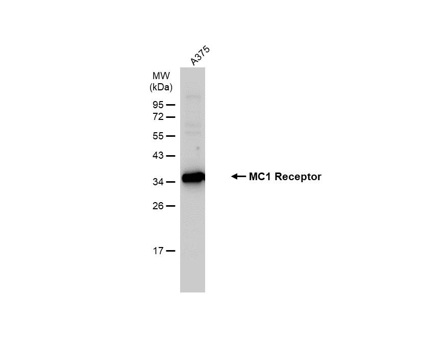 Western blot - Anti-MC1-R antibody [HL1470] - BSA and Azide free (AB313854), expandable thumbnail