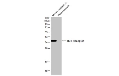 Western blot - Anti-MC1-R antibody [HL1470] - BSA and Azide free (AB313854), expandable thumbnail