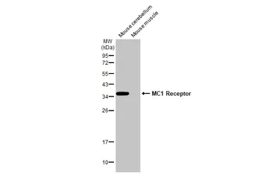 Western blot - Anti-MC1-R antibody [HL1470] - BSA and Azide free (AB313854)