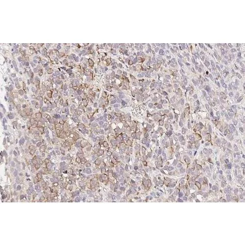 Immunohistochemistry (Formalin/PFA-fixed paraffin-embedded sections) - Anti-MC1 Receptor antibody [HL1471] (AB317088)