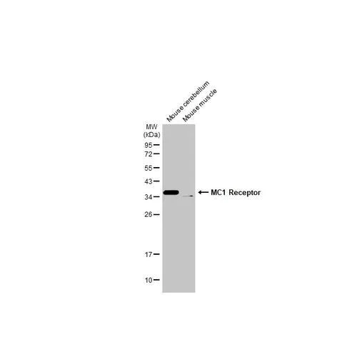 Western blot - Anti-MC1 Receptor antibody [HL1471] (AB317088)