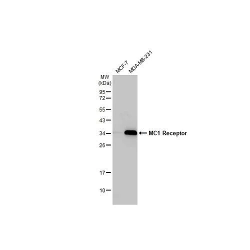 Western blot - Anti-MC1 Receptor antibody [HL1471] (AB317088)