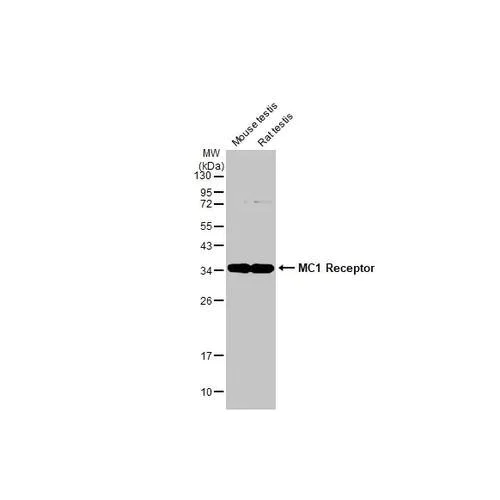Western blot - Anti-MC1 Receptor antibody [HL1471] (AB317088)