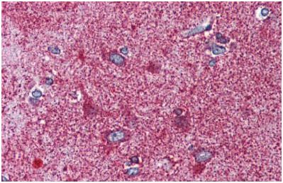 Immunohistochemistry (Formalin/PFA-fixed paraffin-embedded sections) - Anti-MC3-R antibody (AB140864)