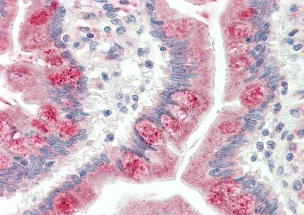 Immunohistochemistry (Formalin/PFA-fixed paraffin-embedded sections) - Anti-MC3-R antibody (AB230451)