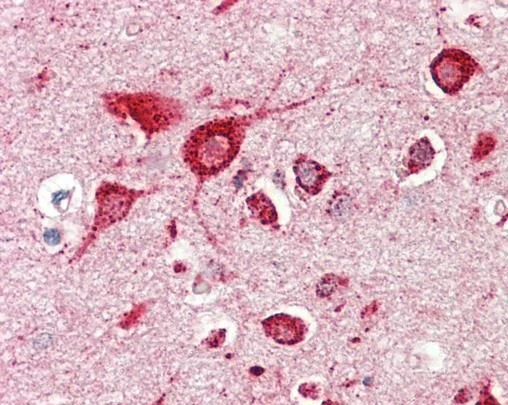 Immunohistochemistry (Formalin/PFA-fixed paraffin-embedded sections) - Anti-MC3-R antibody (AB230451)
