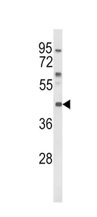 Western blot - Anti-MC3-R antibody (AB230451)