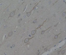 Immunohistochemistry (Formalin/PFA-fixed paraffin-embedded sections) - Anti-MC4-R antibody (AB24233)