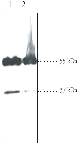 Western blot - Anti-MC4-R antibody (AB24233)