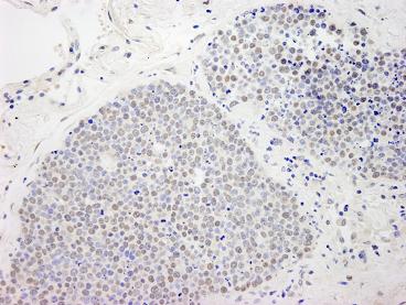 Immunohistochemistry (Formalin/PFA-fixed paraffin-embedded sections) - Anti-MCAF1 antibody (AB84497)