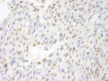 Immunohistochemistry (Formalin/PFA-fixed paraffin-embedded sections) - Anti-MCAF1 antibody (AB84497)