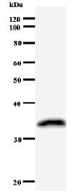 Western blot - Anti-MCAK antibody [2488C3a] (AB50778), expandable thumbnail