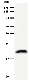Western blot - Anti-MCAK antibody [2488C3a] (AB50778)