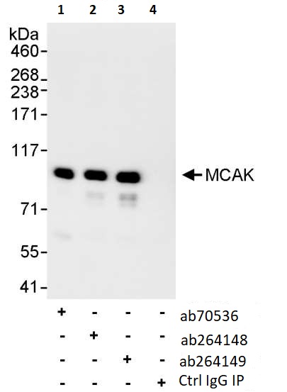 Immunoprecipitation - Anti-MCAK antibody (AB264149), expandable thumbnail
