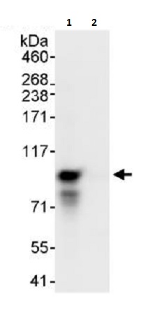 Immunoprecipitation - Anti-MCAK antibody (AB264149), expandable thumbnail