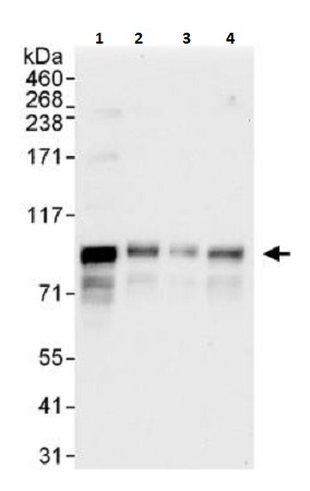 Western blot - Anti-MCAK antibody (AB264149), expandable thumbnail