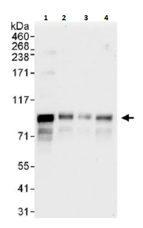 Western blot - Anti-MCAK antibody (AB264149)