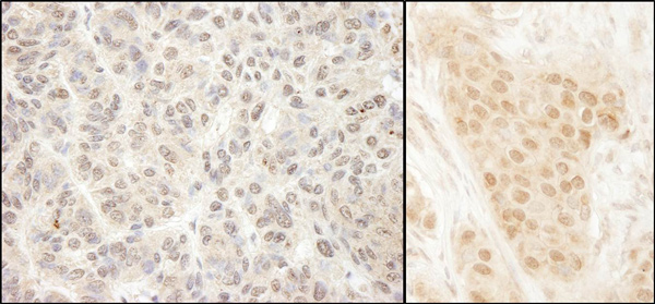 Immunohistochemistry (Formalin/PFA-fixed paraffin-embedded sections) - Anti-MCAK antibody (AB70536), expandable thumbnail