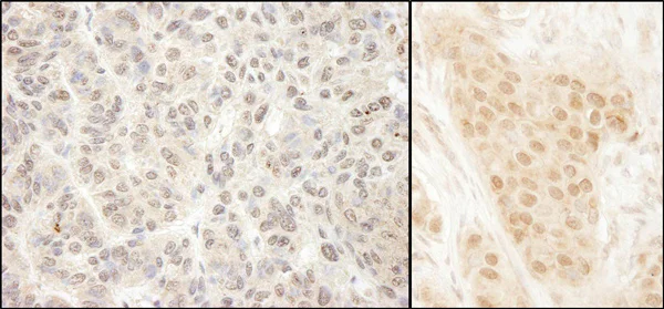 Immunohistochemistry (Formalin/PFA-fixed paraffin-embedded sections) - Anti-MCAK antibody (AB70536)
