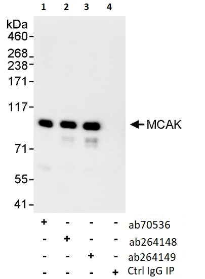 Immunoprecipitation - Anti-MCAK antibody (AB70536)