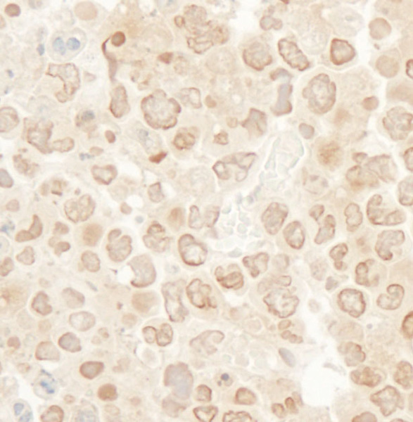 Immunohistochemistry (Formalin/PFA-fixed paraffin-embedded sections) - Anti-MCAK antibody (AB71706), expandable thumbnail