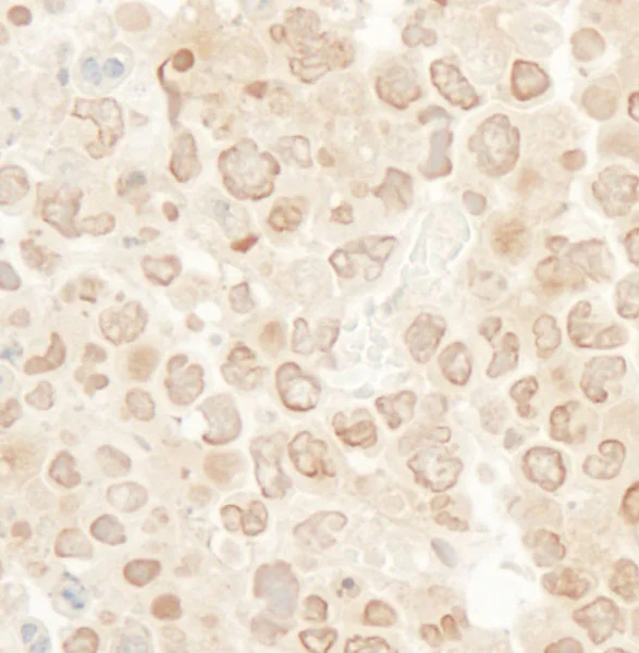 Immunohistochemistry (Formalin/PFA-fixed paraffin-embedded sections) - Anti-MCAK antibody (AB71706)