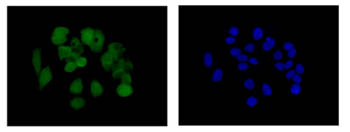 Immunocytochemistry/ Immunofluorescence - Anti-MCAK antibody [EPR14838] (AB187652), expandable thumbnail
