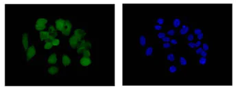 Immunocytochemistry/ Immunofluorescence - Anti-MCAK antibody [EPR14838] (AB187652)