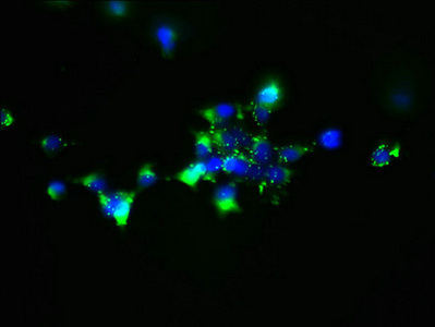 Immunocytochemistry/ Immunofluorescence - Anti-MCART1 antibody (AB237054)