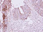 Immunohistochemistry (Formalin/PFA-fixed paraffin-embedded sections) - Anti-MCC antibody (AB125920), expandable thumbnail
