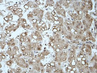 Immunohistochemistry (Formalin/PFA-fixed paraffin-embedded sections) - Anti-MCCC1 antibody (AB197282), expandable thumbnail