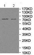 Western blot - Anti-MCCC1 antibody (AB197282), expandable thumbnail