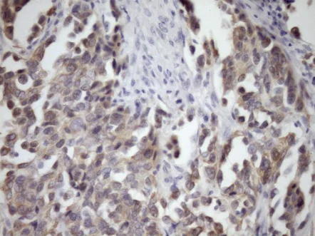 Immunohistochemistry (Formalin/PFA-fixed paraffin-embedded sections) - Anti-MCEE antibody [OTI1B5] (AB236397)