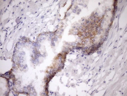 Immunohistochemistry (Formalin/PFA-fixed paraffin-embedded sections) - Anti-MCEE antibody [OTI1B5] (AB236397)