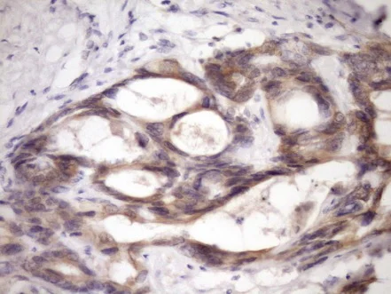 Immunohistochemistry (Formalin/PFA-fixed paraffin-embedded sections) - Anti-MCEE antibody [OTI1B5] (AB236397)