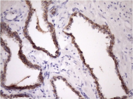 Immunohistochemistry (Formalin/PFA-fixed paraffin-embedded sections) - Anti-MCEE antibody [OTI1B5] (AB236397)