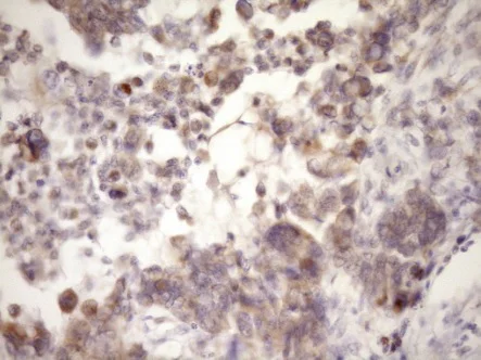 Immunohistochemistry (Formalin/PFA-fixed paraffin-embedded sections) - Anti-MCEE antibody [OTI1B5] (AB236397)