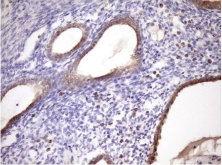 Immunohistochemistry (Formalin/PFA-fixed paraffin-embedded sections) - Anti-MCEE antibody [OTI1B5] (AB236397)