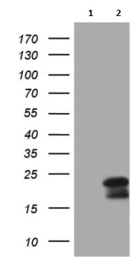 Western blot - Anti-MCEE antibody [OTI1B5] (AB236397)