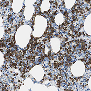 Immunohistochemistry (Formalin/PFA-fixed paraffin-embedded sections) - Anti-MCEMP1 antibody (AB121447)