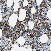 Immunohistochemistry (Formalin/PFA-fixed paraffin-embedded sections) - Anti-MCEMP1 antibody (AB121447)