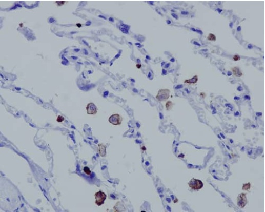 Immunohistochemistry (Formalin/PFA-fixed paraffin-embedded sections) - Anti-MCEMP1 antibody [EPR14393] - C-terminal (AB188572)